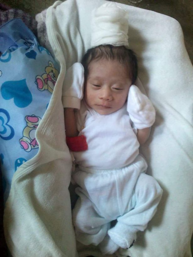 Đi khám thai đầy đủ và được thông báo thai nhi bình thường, bà mẹ choáng váng nhìn con chào đời có một cái sừng ở trên đầu-4