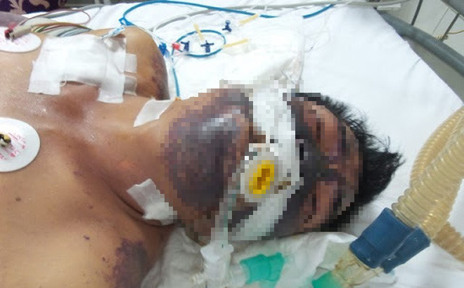 Ăn món khoái khẩu, nam thanh niên Hà Nội&nbsp;mất ý thức, hôn mê, suýt mất mạng-1