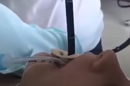 Video: Bác sĩ Nga kéo con rắn dài hơn 1m ra khỏi miệng bệnh nhân