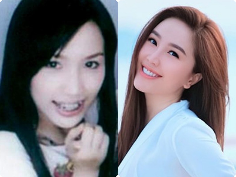 Không phải giảm cân, cũng chẳng do dao kéo, nhan sắc Hòa Minzy thăng hạng chỉ nhờ thay đổi một điểm trên khuôn mặt-6