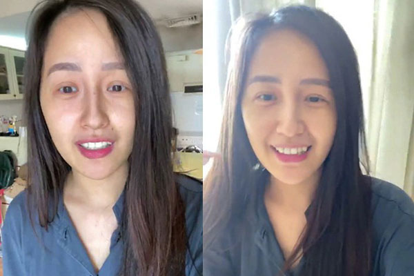 Mai Phương Thuý khiến fan lo lắng khi đăng ảnh nhập viện cấp cứu-5