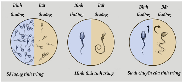 Nam giới thường xuyên làm việc này vào ban đêm thì chất lượng tinh trùng kém đi trông thấy, không thay đổi ngay có thể dẫn đến vô sinh-2