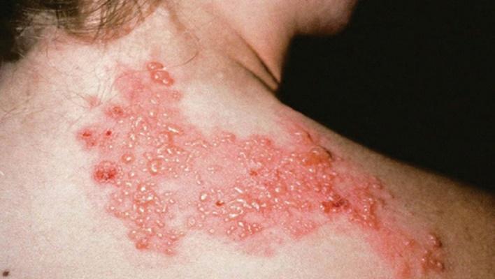 Cách đuổi kiến ba khoang khỏi nhà hiệu quả, người nào ở chung cư nên học hỏi ngay-2