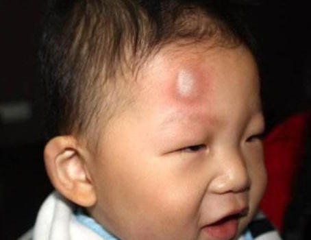 Cháu 1 tuổi ngã trên giường xuống, thái độ của mẹ làm bà nội khó chịu, bác sĩ lại khen-1