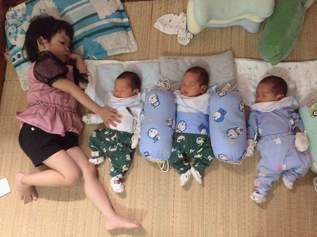 Mang thai 3 cực hiếm gặp, mẹ 9x bụng rạn chi chít ai cũng sợ không vác nổi, đẻ xong còn khủng khiếp hơn-9