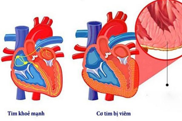 Bệnh nhân ở Hà Nam bất ngờ dương tính với SARS-CoV-2 khi sắp xuất viện-4