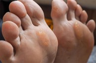 Nếu bỗng dưng thấy bàn chân có 5 sự thay đổi này, coi chừng cơ thể đang mắc trọng bệnh và cần được 'giải cứu' lập tức