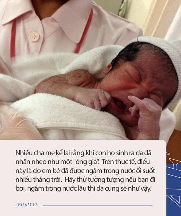 Từng sốc không nói nên lời khi sinh ra em bé đen sì như Bao Công, nhưng ngoại hình sau 2 tháng khiến ai cũng ngỡ ngàng-4