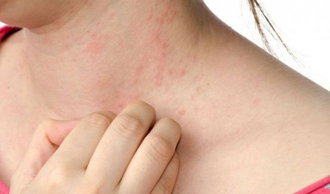 2 vị trí trên cơ thể bị ngứa, 80% là do bệnh gan và có 3 loại thực phẩm gây hại cho gan bạn nên tránh-2