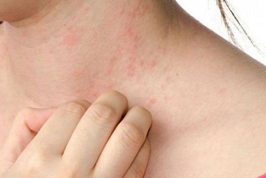 2 vị trí trên cơ thể bị 