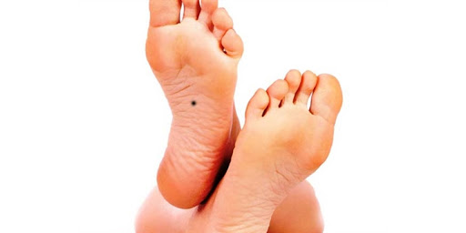 Chỉ cần nhìn nốt ruồi ở vị trí này biết ngay tương lai giàu sang hay nghèo hèn-4