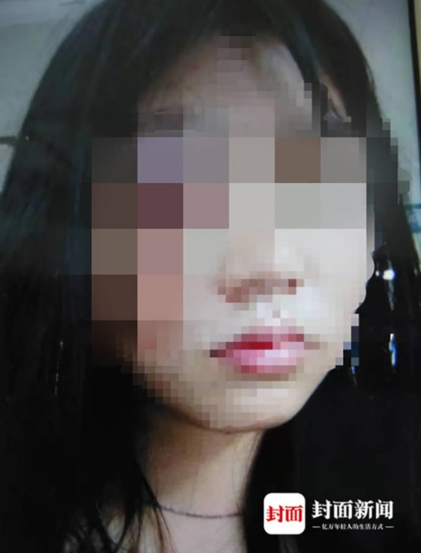 Người phụ nữ ôm gương mặt bê bết máu chạy đến bệnh viện, tiết lộ bi kịch bạo hành gia đình suốt 5 năm và suýt bị chồng chôn sống-1