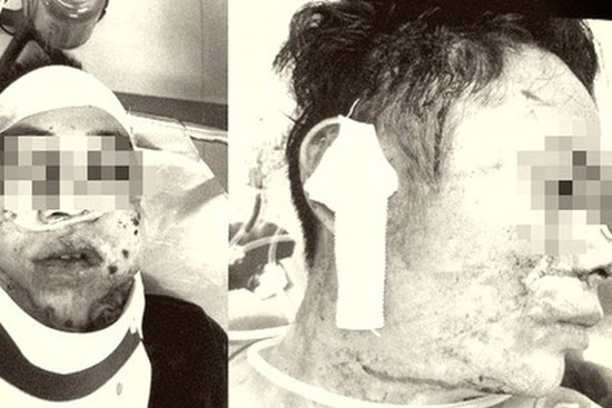 Truy tìm nhóm có biệt danh Voi, Cọp, Báo nổ súng truy sát 2 người vì 1 phụ nữ