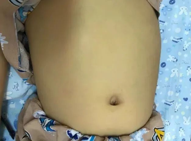 Cháu trai 8 tuổi tổn thương gan nghiêm trọng vì loại đồ uống mà ông nội cho uống mỗi ngày: 4 loại nước vô cùng nguy hiểm với trẻ nhỏ nhưng bố mẹ vẫn thờ ơ-2