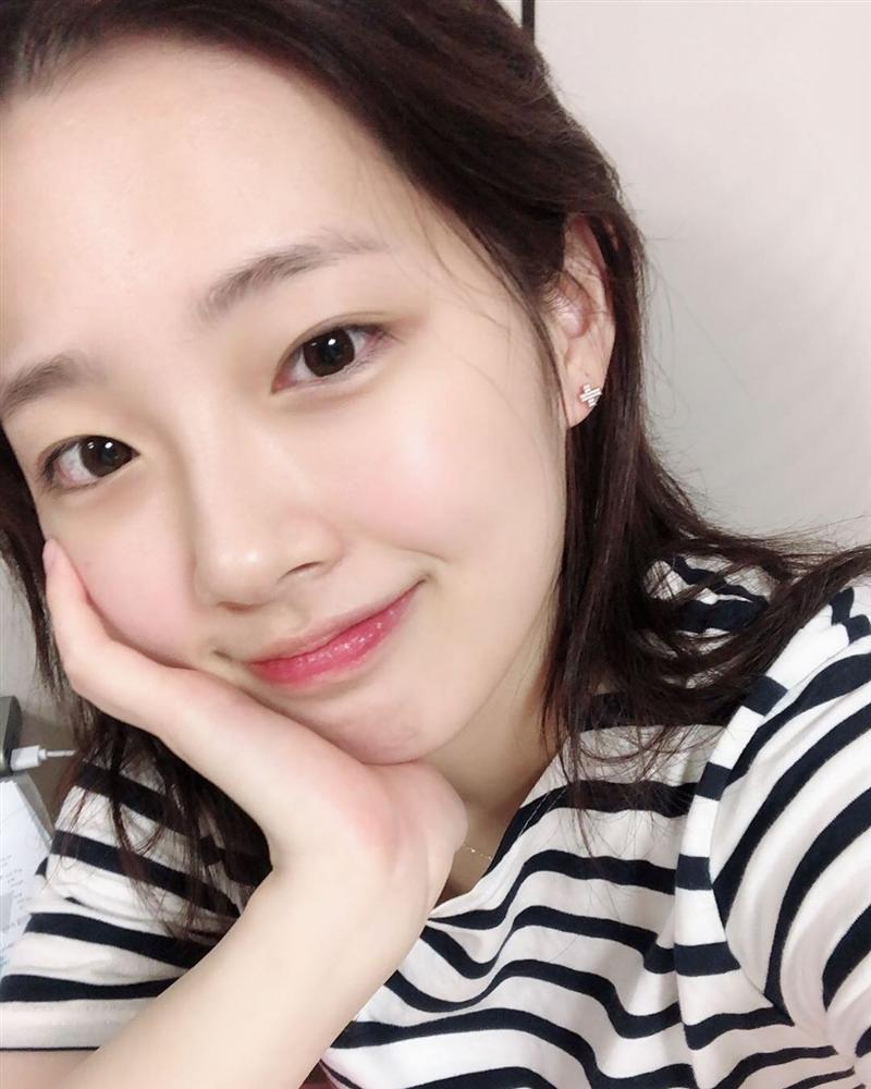 5 lọ toner AHA tẩy da chết đỉnh cao: Tái sinh làn da từ sần sùi đầy rẫy mụn ẩn thành láng mịn, trắng sáng chỉ trong vài tuần-1