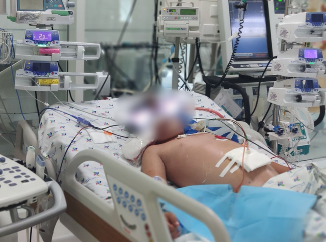 Bé trai 13 tuổi biến chứng suy đa cơ quan nặng vì sốt xuất huyết: Bác sĩ cảnh báo căn bệnh nguy hiểm-1