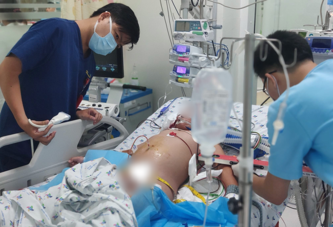 Bé trai 13 tuổi biến chứng suy đa cơ quan nặng vì sốt xuất huyết: Bác sĩ cảnh báo căn bệnh nguy hiểm-2