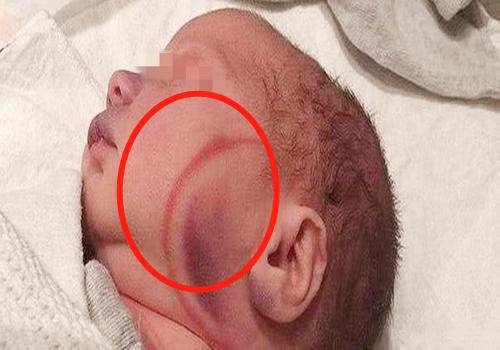 Vừa nhìn mặt cháu nội mới ra đời, mẹ chồng liền mắng con dâu té tát: Đồ không biết đẻ!”-2