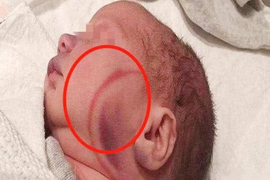 Vừa nhìn mặt cháu nội mới ra đời, mẹ chồng liền mắng con dâu té tát: “Đồ không biết đẻ!”