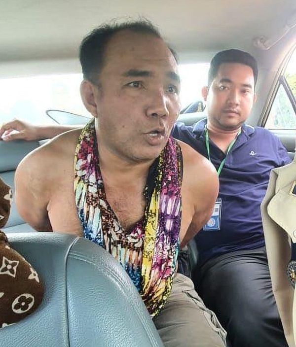 Nói lời chia tay đường đột, cô gái trẻ bị tạt axit, mất một tay vì gã bạn trai thú tính, cả cuộc đời bị hủy hoại vì yêu nhầm người-3