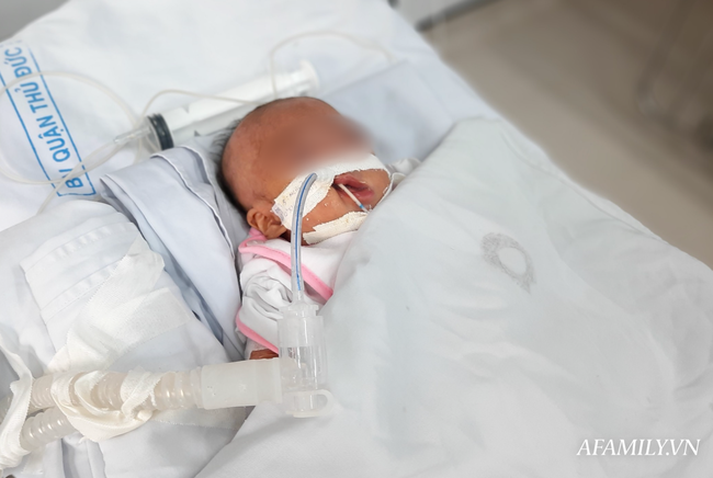 Bé trai sơ sinh người đầy vết tiêm chích bị bỏ rơi trước cổng chùa ở Sài Gòn: Vẫn chưa thể cai máy thở, đang chờ xét nghiệm ADN người đến nhận-2