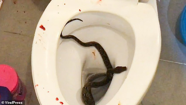 Chàng trai bị bé Na phục kích trong bồn cầu đớp trúng của quý khi đang đi vệ sinh-2