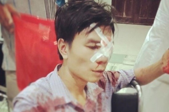 Cán bộ địa chính bị tố dùng xẻng đánh người nhập viện sau va chạm giao thông