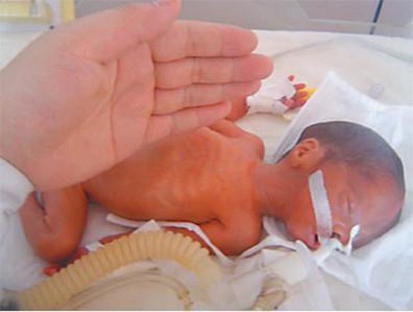 8 lần phá thai, đến lần thứ 9 gái trẻ sinh con nhưng gia đình không ai dám bế-2