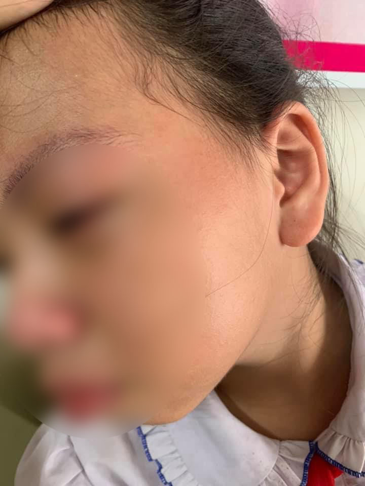 Vụ cô giáo ở Hà Giang tát đỏ mặt học sinh ngay trong buổi học đầu tiên: Hiệu trưởng đã chính thức ra quyết định-1