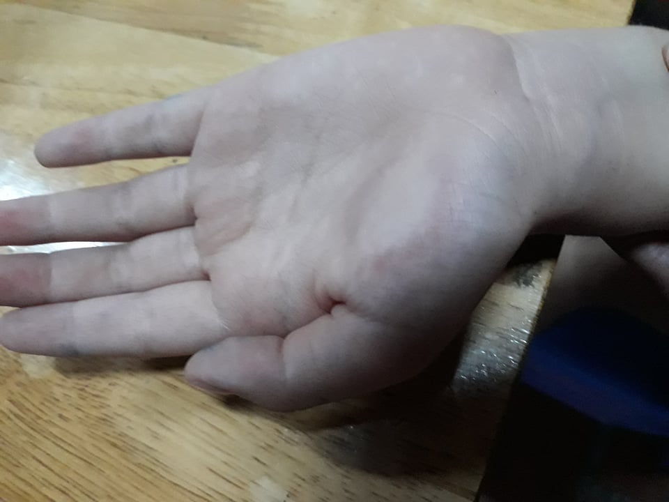 Vụ cô giáo ở Hà Giang tát đỏ mặt học sinh ngay trong buổi học đầu tiên: Hiệu trưởng đã chính thức ra quyết định-4