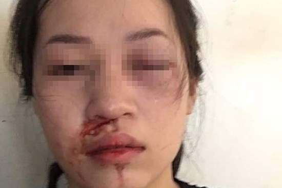 CSGT Tuyên Quang lên tiếng sau khi bị tố dùng gậy vụt vào mặt người phụ nữ vì không chấp hành hiệu lệnh dừng xe