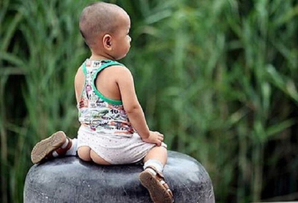 Bé gái 1 tuổi mắc bệnh lây truyền qua đường tình dục, thủ phạm là cách mặc quần mà nhiều cha mẹ mắc-1