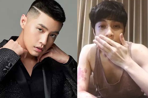 Noo Phước Thịnh lần đầu tiên xác nhận tin đồn rạn nứt tình bạn với Đông Nhi là chính xác-2