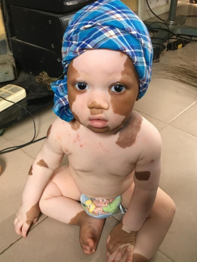 Con trai sinh ra có màu da lạ, ông bố đã làm 1 việc vô cùng đặc biệt cho con và được bao bố mẹ khắp thế giới tìm đến-1