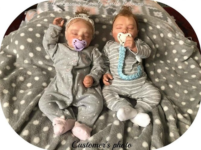 Con trai sinh ra có màu da lạ, ông bố đã làm 1 việc vô cùng đặc biệt cho con và được bao bố mẹ khắp thế giới tìm đến-8