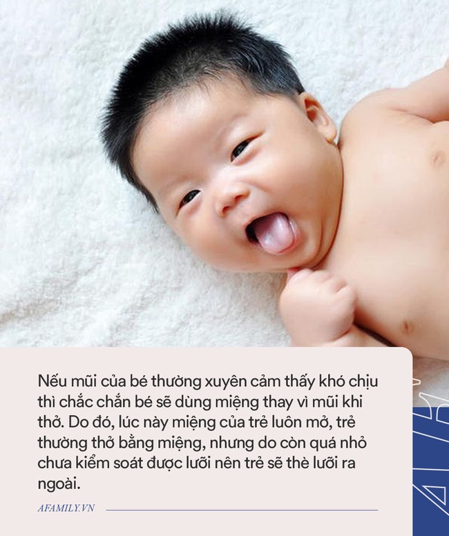 Bé hay thè lưỡi có thể là dấu hiệu của bệnh, bố mẹ không được bỏ qua-2
