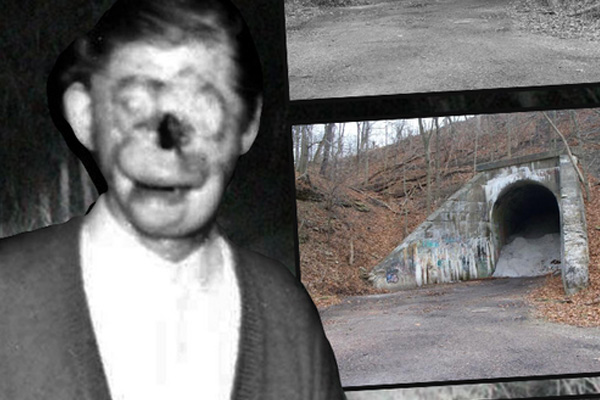 Thiếu nữ 17 tuổi bị biến dạng khuôn mặt sắp mù chỉ vì một hành động vô tư nhiều người vẫn làm, dáng vẻ trước khi gặp họa càng gây xót xa-4