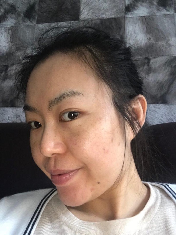 3 thành phần được ví như phép màu hồi sinh làn da bị nám, tàn nhang: Chị em ngoài 30 tuổi da đang lão hóa cần tìm hiểu ngay còn kịp-1