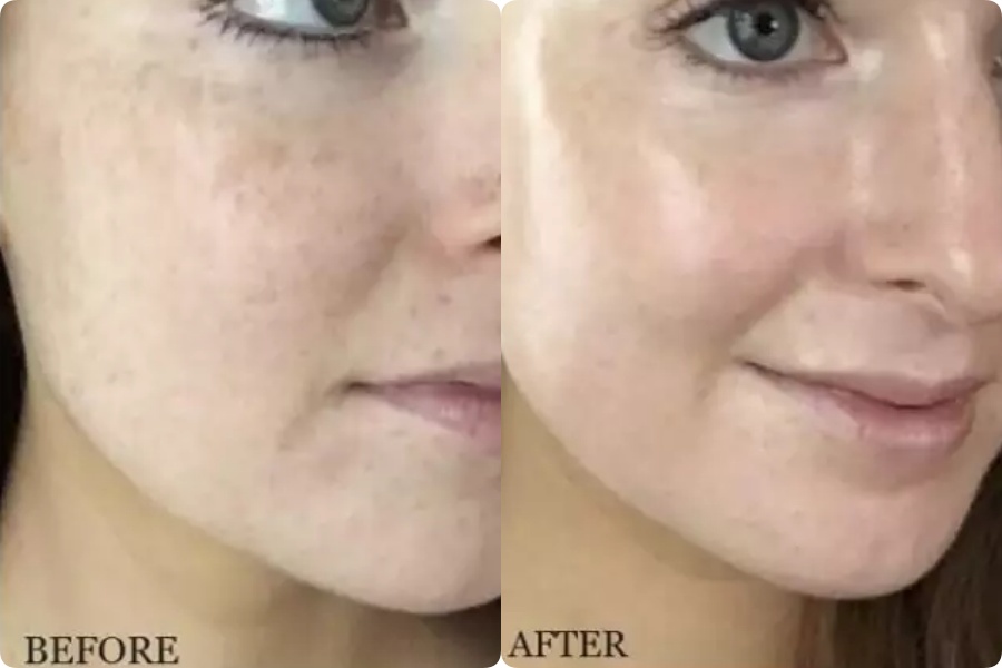 3 thành phần được ví như phép màu hồi sinh làn da bị nám, tàn nhang: Chị em ngoài 30 tuổi da đang lão hóa cần tìm hiểu ngay còn kịp-6