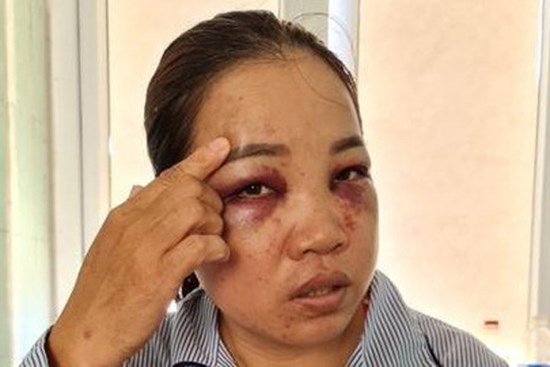 Người đàn bà bị chồng cũ tìm đến tận nhà đánh đập dã man
