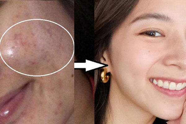 Có ý thức chống lão hóa từ sớm nhưng lơ là 4 quy tắc chăm da cơ bản sau thì bạn vẫn già xọm như thường-4