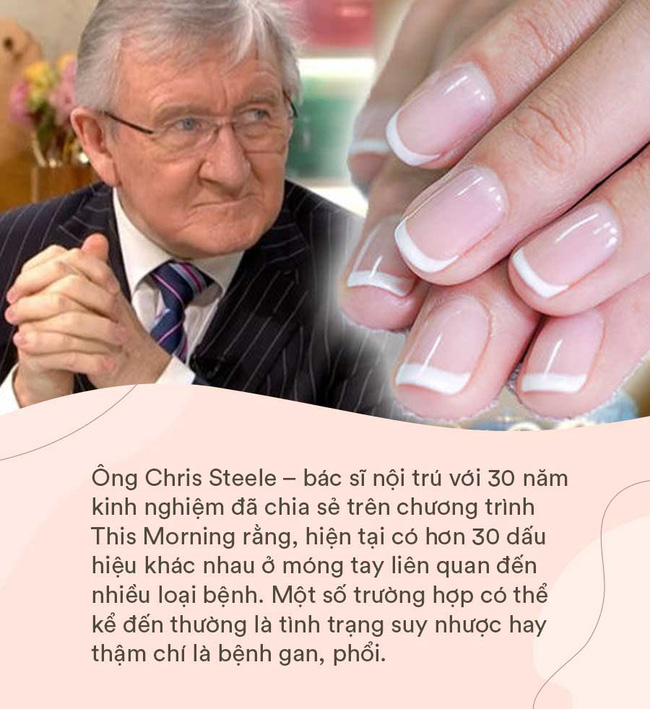 4 dấu hiệu trên móng tay chỉ điểm” trong người bạn đang có mầm bệnh-4