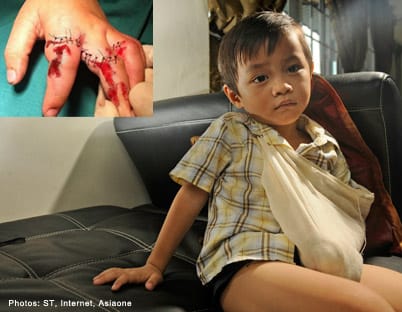 Bé trai 3 tuổi bị mắc kẹt chân trong thang cuốn ở trung tâm thương mại chỉ vì đôi giày quen thuộc mà các mẹ hay mua cho con-3