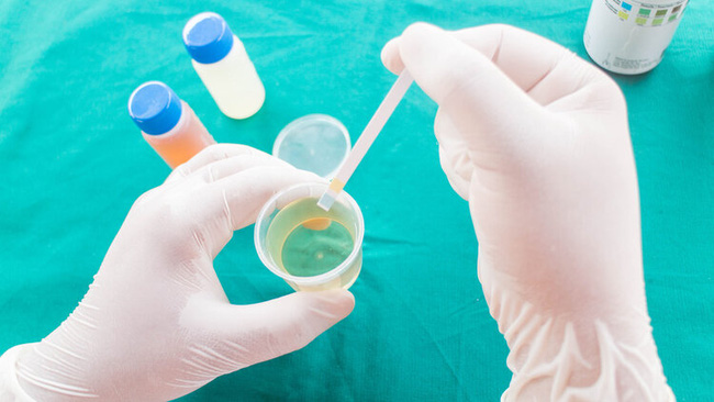 Cha mẹ cứng đầu nhất định không làm theo lời bác sĩ, 2 năm sau cậu bé 11 tuổi phát hiện bị bệnh thận giai đoạn cuối-3