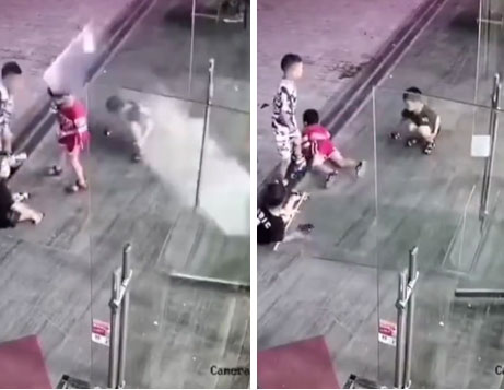 Bé trai chấn thương sọ não vì bị kính đè, toàn bộ cảnh tượng khiến ai cũng thót tim nhưng dư luận lại chỉ trích những người xung quanh-1