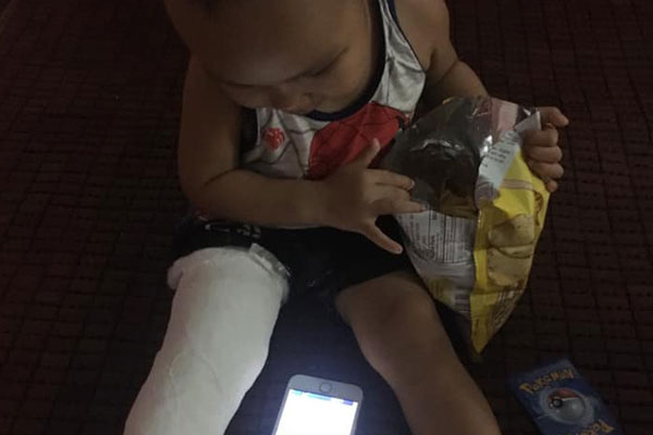 Nhà trường lên tiếng sau vụ bé gái 5 tuổi ngã gãy tay, nguy cơ bị liệt khi đang trong giờ học-7