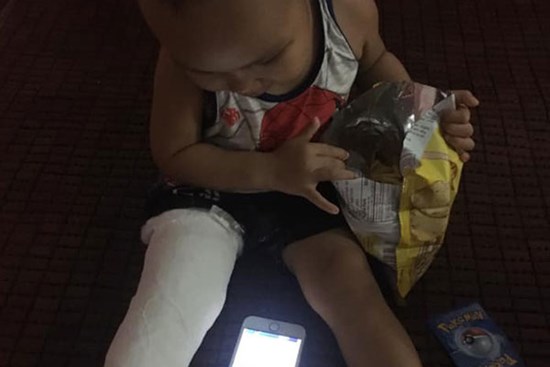 Xôn xao bé trai 2 tuổi ở Thái Nguyên gãy chân sau khi đến lớp, gia đình
