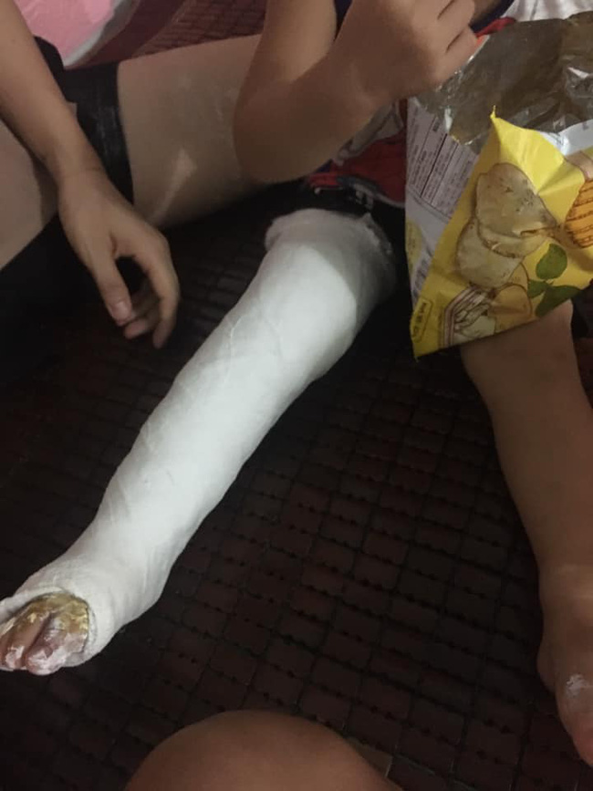 Xôn xao bé trai 2 tuổi ở Thái Nguyên gãy chân sau khi đến lớp, gia đình tố cô giáo tự đưa đến trạm y tế mà không thông báo-2