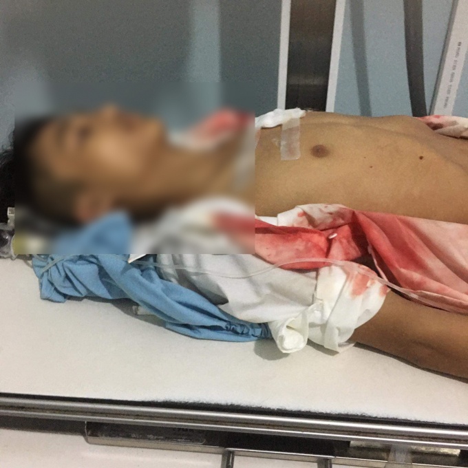 Nam sinh lớp 11 ở Hà Giang bị bạn đâm thấu ngực tại cổng trường-2