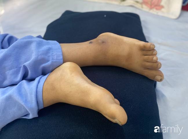 Cô gái 26 tuổi mắc bệnh Down bị bỏ rơi 20 năm nay lại gặp tai nạn lâm nguy, bệnh viện khẩn cầu cộng đồng giúp đỡ-6
